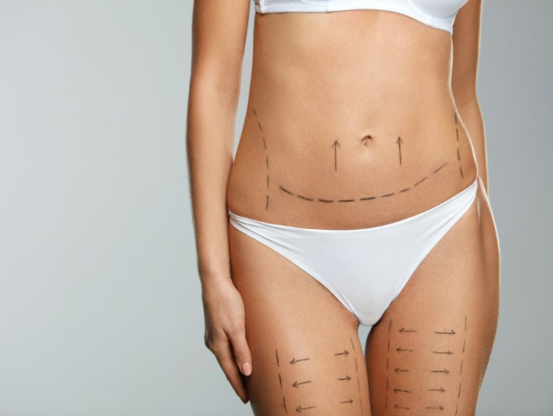 Pós-Operatório de Cirurgia Plástica
